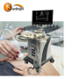 High resolution 22 inch display best trolley 3d/4d color Doppler sunbright digital portable ultrasound