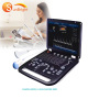 Portable Laptop 3D/4D CW Color Doppler Pregnancy Ultrasound Scanner Machine on sale