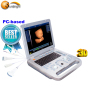 Nuovo ecografo portatile generale USG ecografia doppler a colori diagnostica 3D 4D