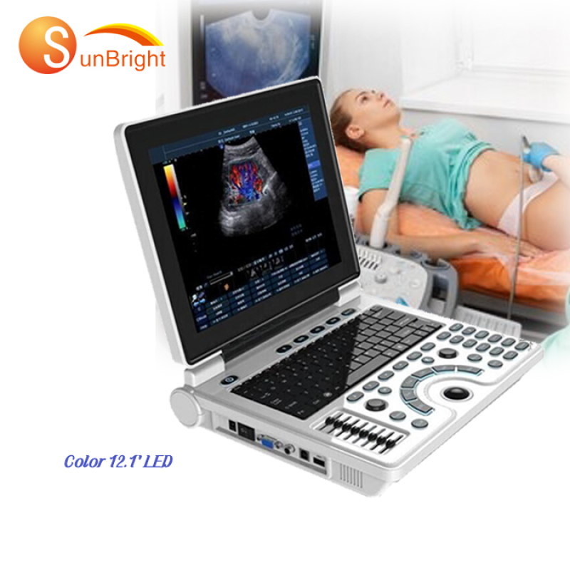 portable msk ultrasound 12.1 inch LED ultrasound machine medical laptop ultrasound color scanner price