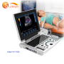 portable msk ultrasound 12.1 inch LED ultrasound machine medical laptop ultrasound color scanner price