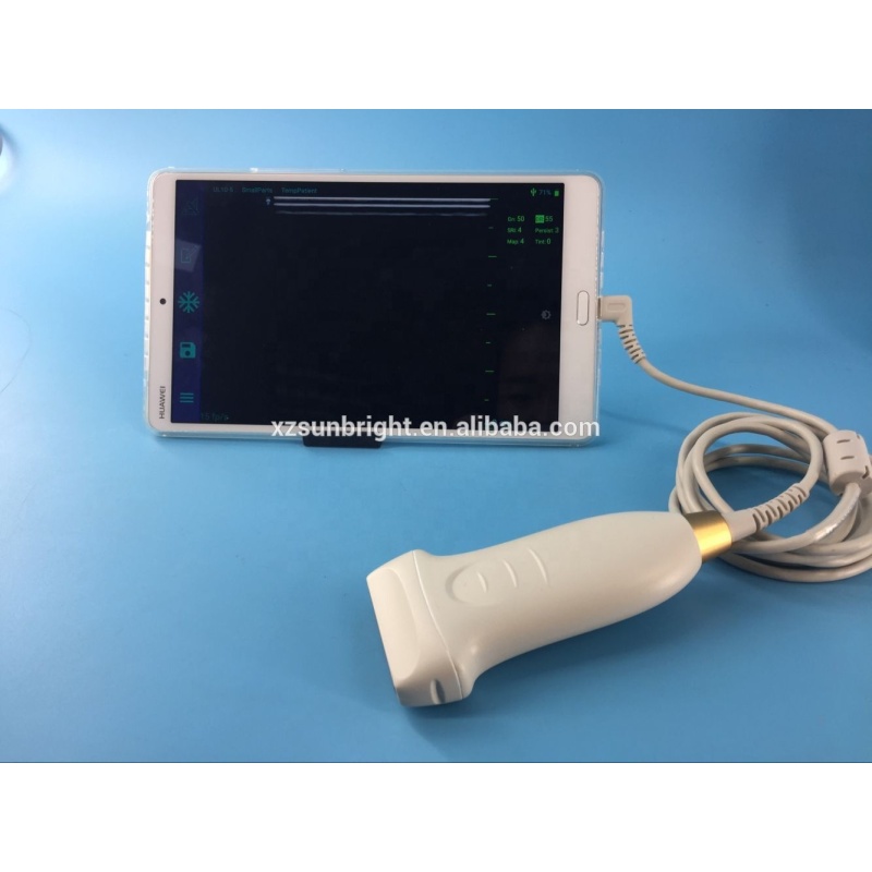 Hot sale Smart  factory price portable usb medical  ultrasound linear probe ultrasound for sale