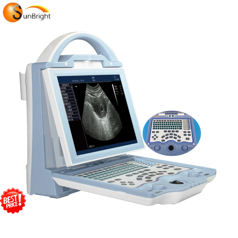 BW Portable Ultrasound System Similar Mindray DP10 Ultrasound Scanner