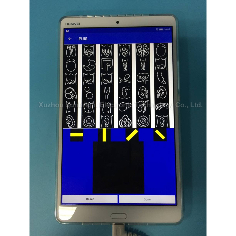 pw wireless phone use Ultrasound Scanner probe SUN-P1