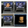 Portable laptop style Medical ecografo 3D ultrasound scanning machine 3D ultrasound scanner