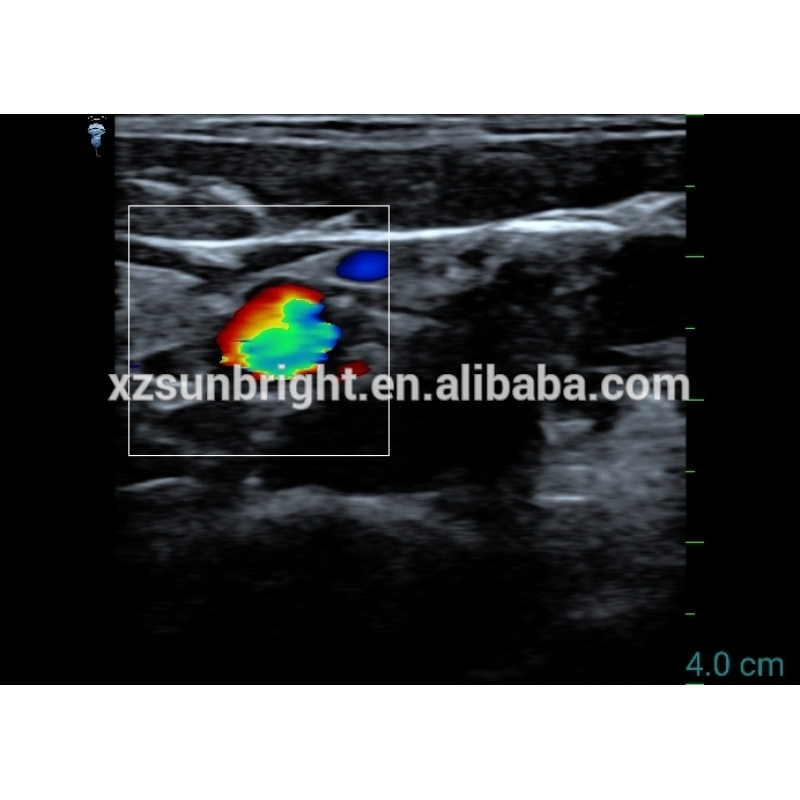 128 elements wifi linear color doppler ultrasound transducer best selling type c usb convex ultrasound probe price