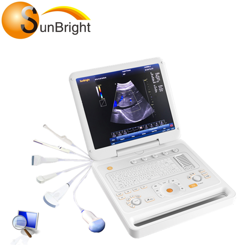 Best Value 3D Portable Color Doppler Ultrasound fetal doppler