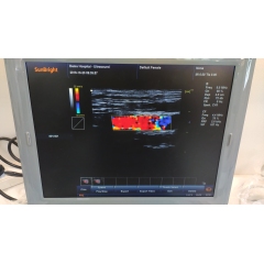 Vascular Ultrasound 3D 4D Elastography Laptop Machine Portable Color Doppler