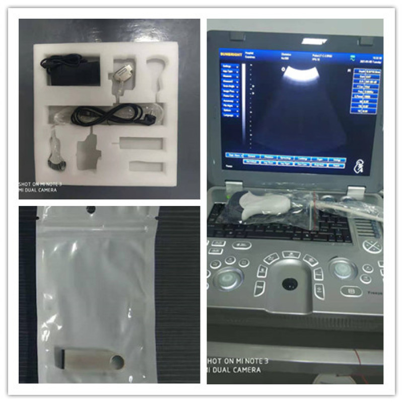 Échographie portable noir blanc de 15 pouces avec logiciel 3D gratuit et fonction multilingue