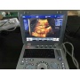 Wholesales price medical 3D LED ultrasound ge logiq e portable ultrasound machine price