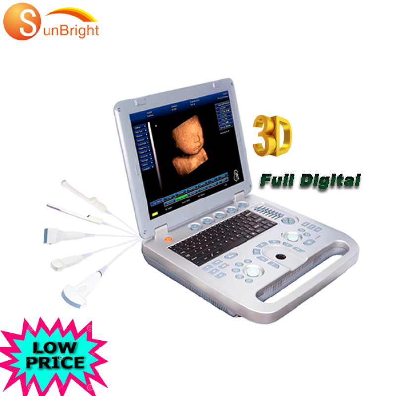 Kosten für tragbare 3D-Hochleistungs-Ultraschallgeräte