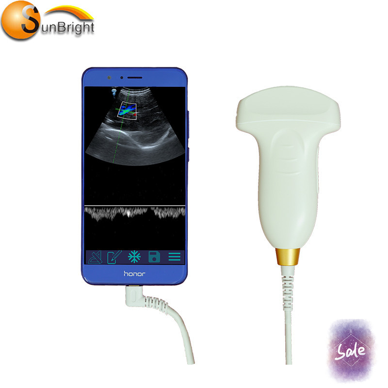 SUN-D1 puerto USB tipo C sonda convexa transductor Doppler convexo oem sonda convexa de ultrasonido