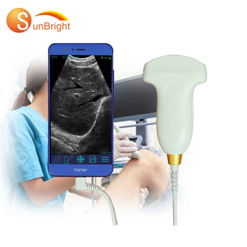 CE Light weight easy to carry usb convex probe ultrasound scanner on sale