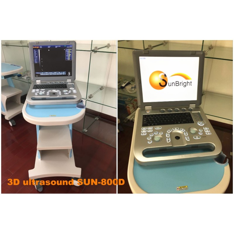 Satisfied and reliable performance 3D ultrasound echo