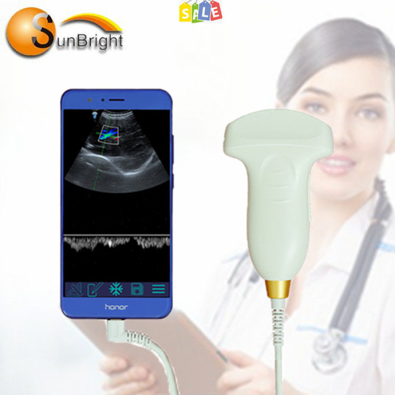 Cable Connect high Clear Image USB convex wireless ultrasound probe for cell phones
