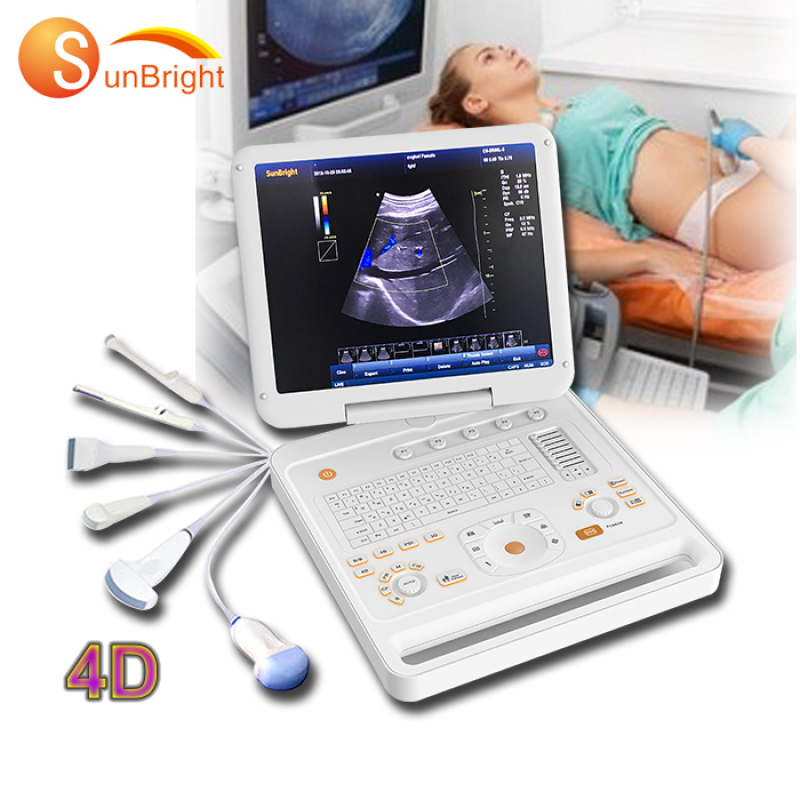 15 inch 128 element 3D/4D CW Color Doppler Ultrasound Machine