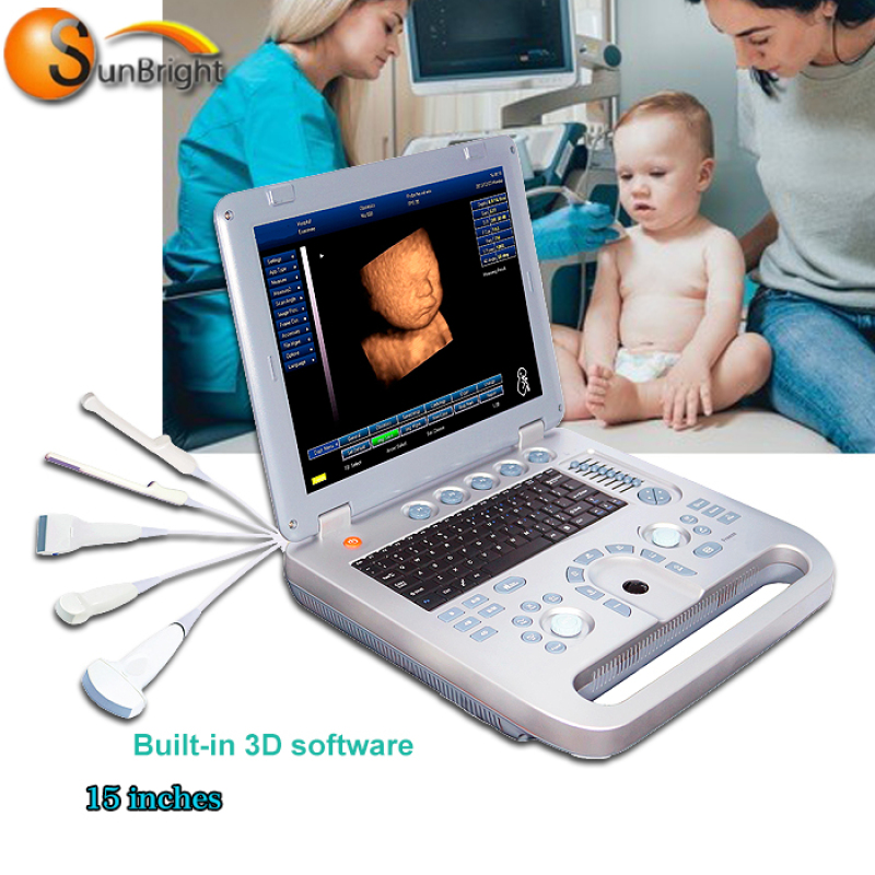 Stampante per scanner ad ultrasuoni 3D ad alta definizione per la salute umana e animale