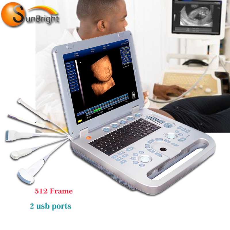 high performance efficient medical portable hospital ultrasound machine price