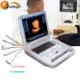 high performance efficient medical portable hospital ultrasound machine price