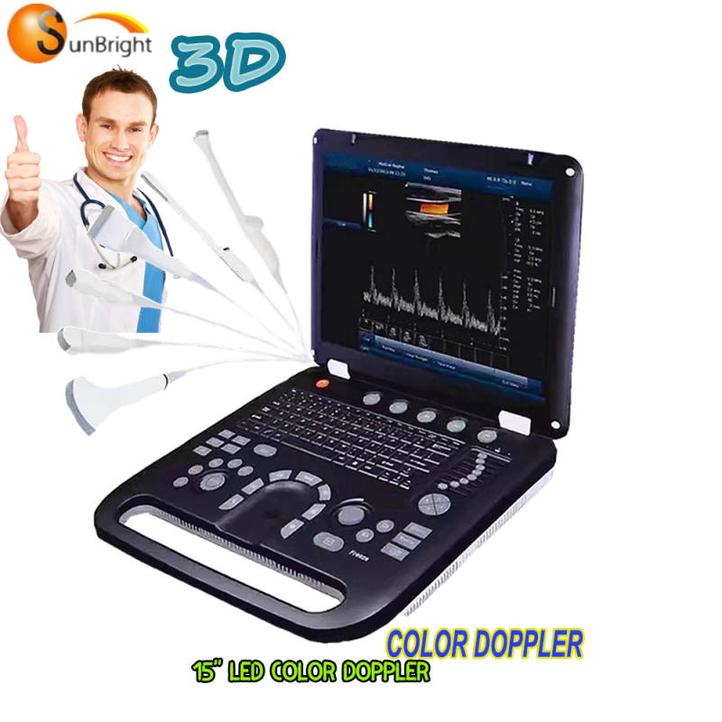 높은 비용 성능 동물 휴대용 초음파 기계 가격