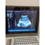 Notebook B/W Ultrasound Machine Sun-806G