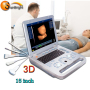 Hospital 3D digital ultrasound system scanner