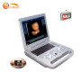 High end echo ultrasound scanner 3D ultrasonic machine cardiac ultrasound equipment price