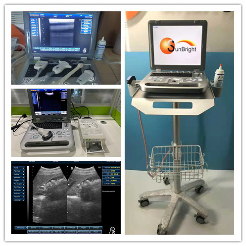 Portable laptop style Medical ecografo 3D 4D ultrasound scanning machine for hospitals