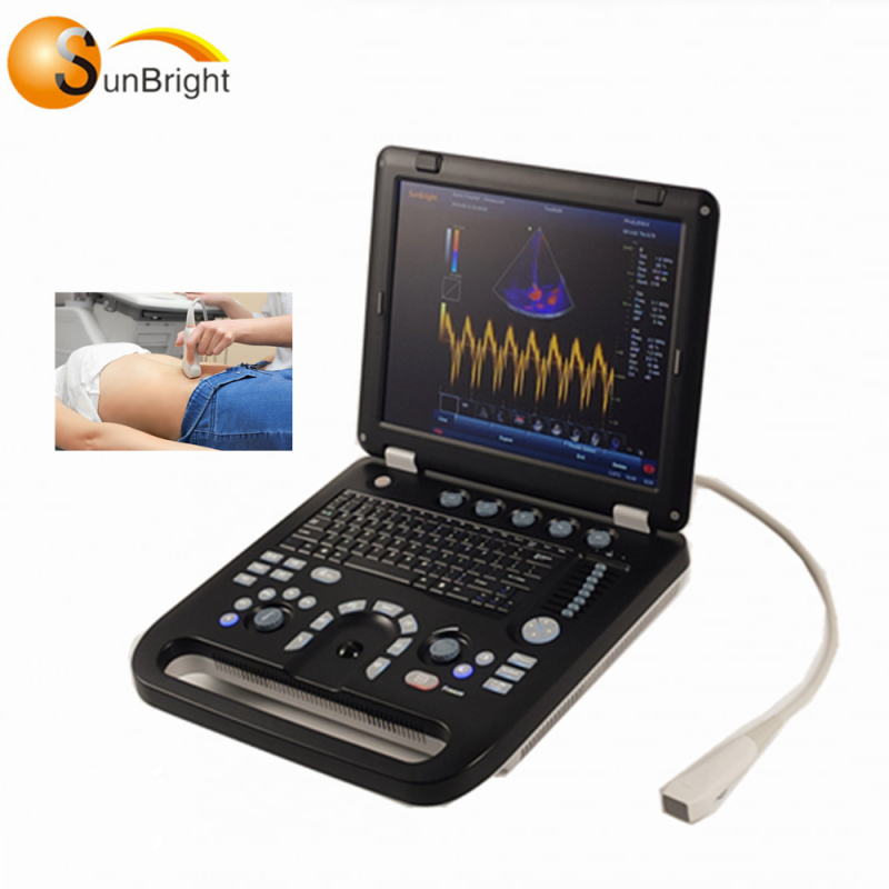 새로운 산부인과 태아 스캔 이미지 컬러 도플러 장치 휴대용 초음파 기계 비용