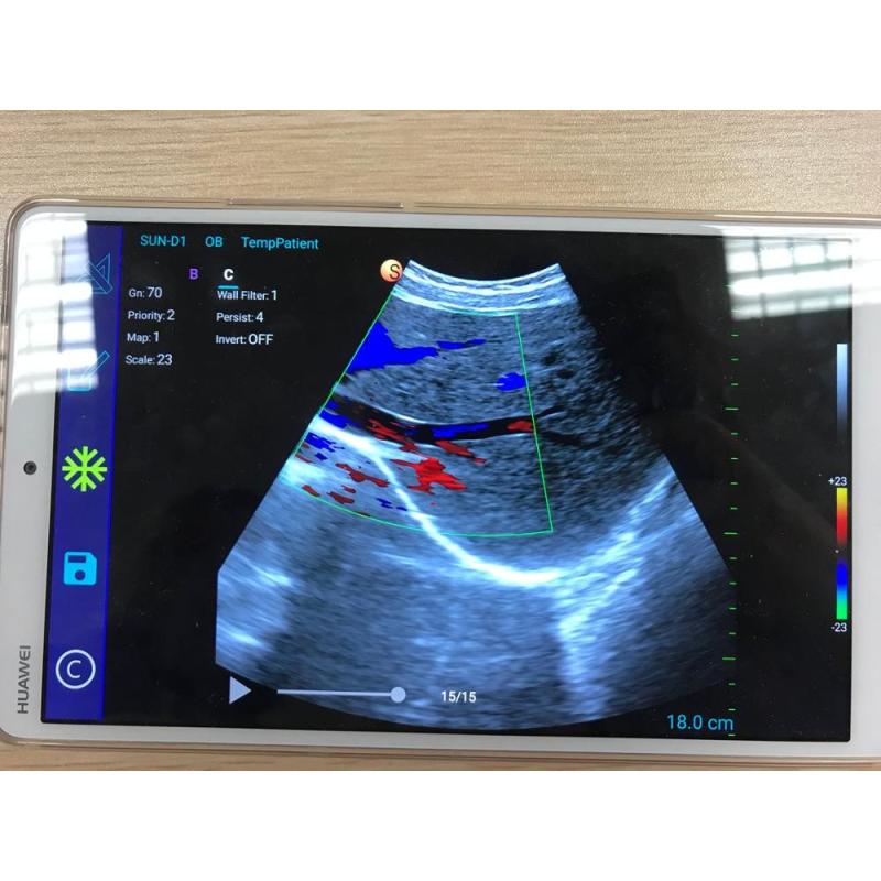 Ipad/Phone Ultrasound Scanner / Usb Ultrasound convex Probe Price