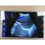 Ipad/Phone Ultrasound Scanner / Usb Ultrasound convex Probe Price