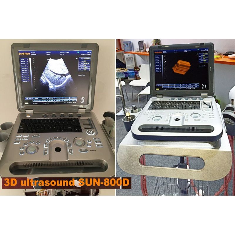 portable abdominal ultrasound clinical high quality machine cheap 3d ultrasound