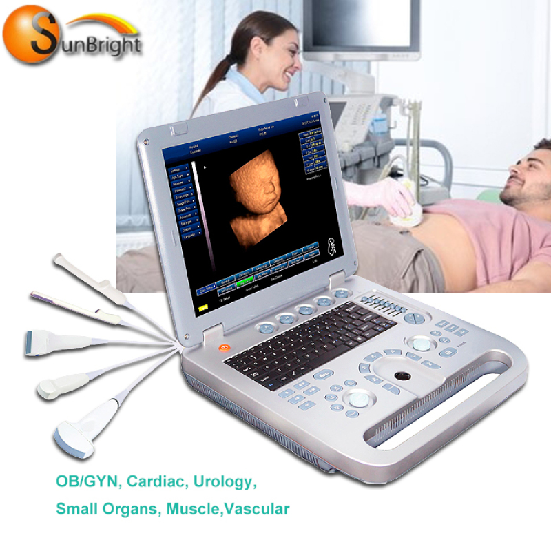simiar with chison eco1 ultrasound best price laptop 3D high end system
