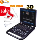 human test ultrasound machine color doppler portable usg 3d ultrasound machine digital portable