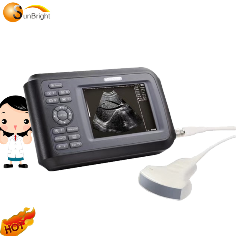 Cardiac 2D handheld ultrasound echocardiography ultrasound echo machine price