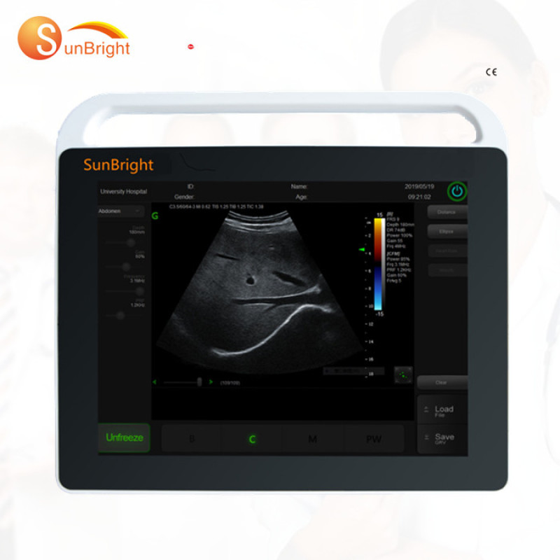 Mindray 초음파 기계 ultrasonido Mindray m7 echograph portabl 가격 Mindray 초음파 장치