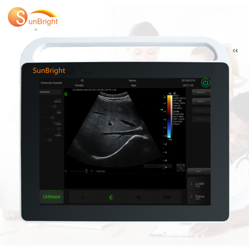 buy VET 15 inch laptop touch screen ultrasound machines convex probe