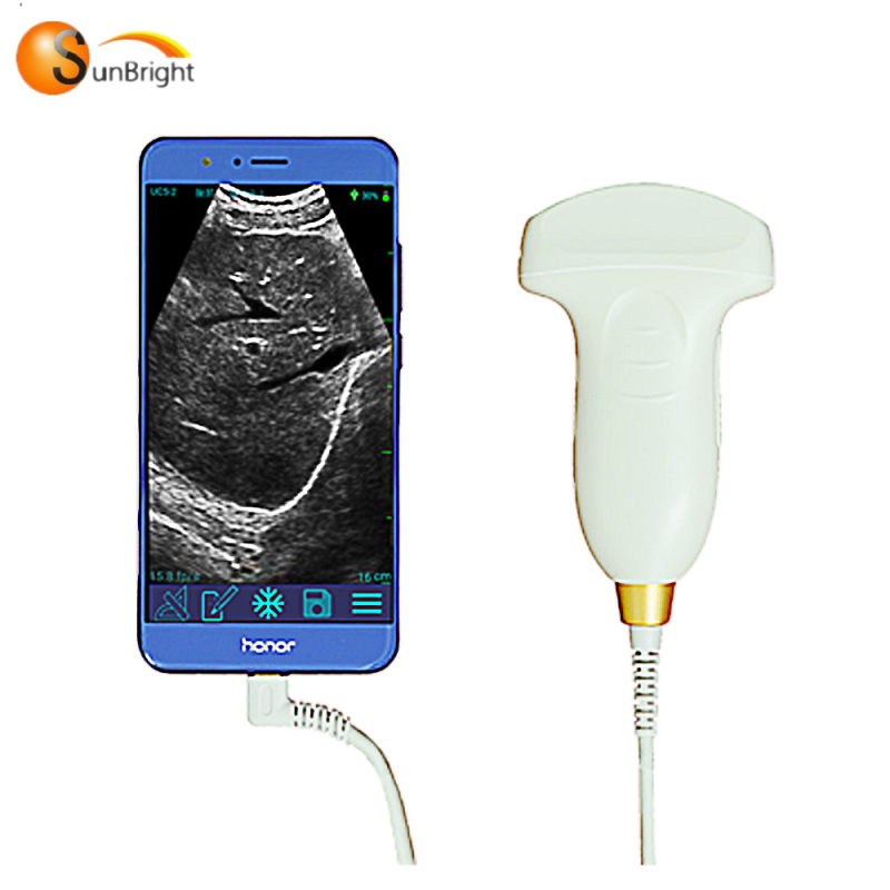 Portable phone tablet connect USB convex probe for vascular anesthesia small parts MSK