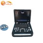 Hot sale Mindray 3d ultrasound equipment portable obstetric ultrasound machine with convex probe