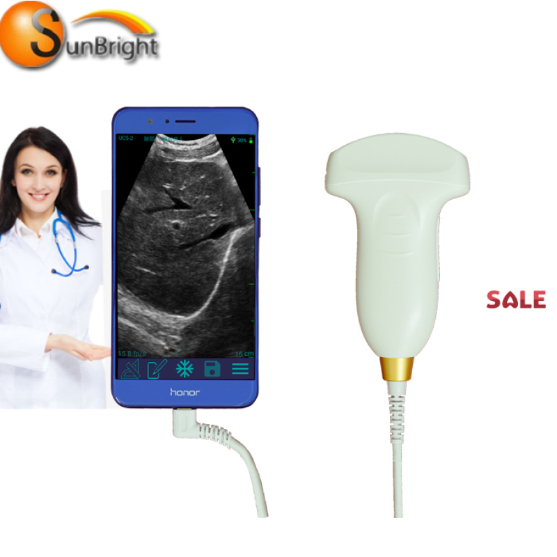 Iphone Ipad Android wireless ultrasound probe scanner wireless USB ultrasound probe