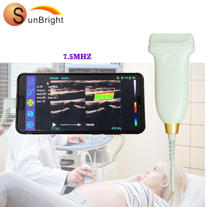 IPhone /Android connect wireless ultrasound machines linear probe/usg wireless probe portable