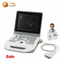 Clinical Hot Selling Laptop 2D BW Ultrasound Pregnancy Fetal Scanning Ultrasound