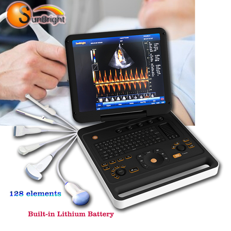 high sensitive full digital well performance medical portable diagnostic 4D color doppler ultrasound equipment