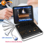 high sensitive full digital well performance medical portable diagnostic 4D color doppler ultrasound equipment