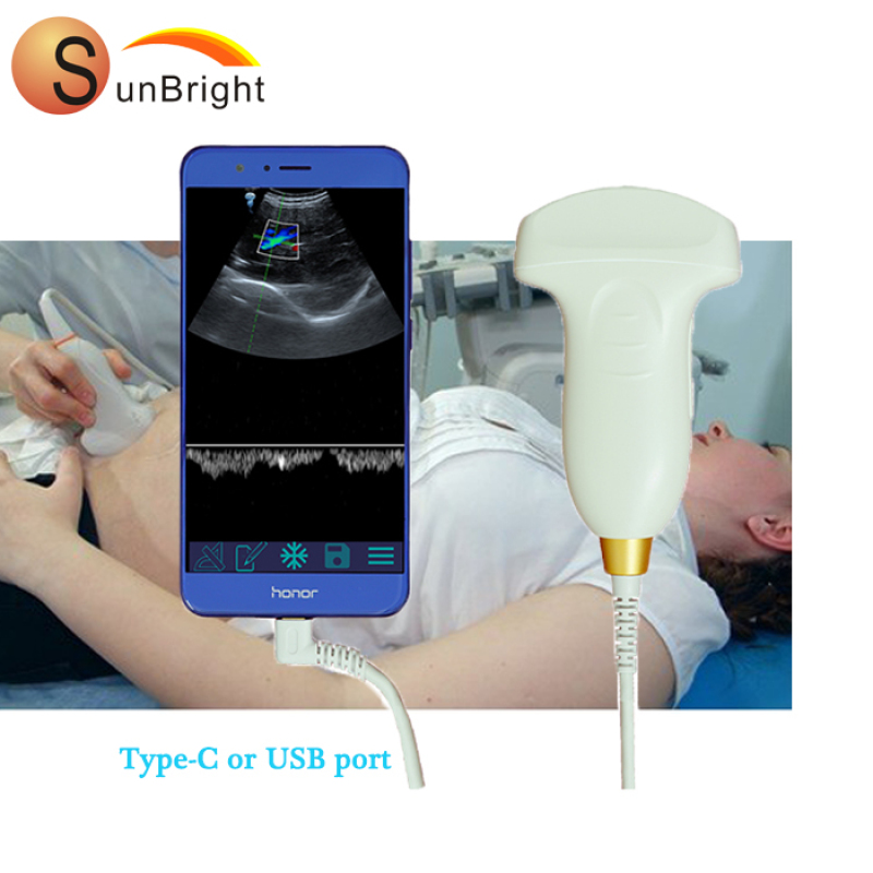 Innovative Design 2020 new type color doppler wireless linear probe with lower price