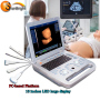 Best ultrasonic scanner for Pregnancy Ultrasound Scanner 3D Ultrasound Machine