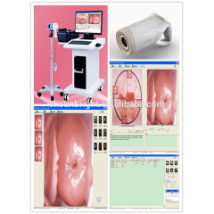 colposcope price Medical gynecology equipment vagina diagnostic full digital colposcope