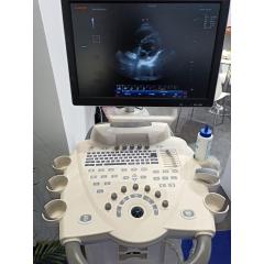 Trolley pregnancy ultrasound scanner color Doppler