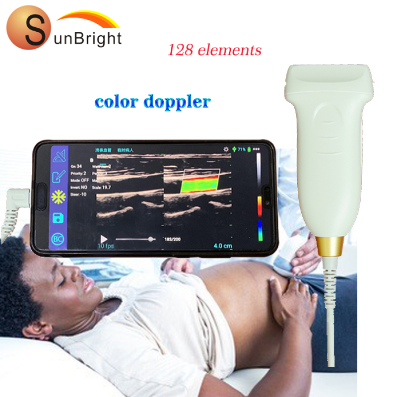 Cable connect clear image type USB convex full digital ultrasound android probe