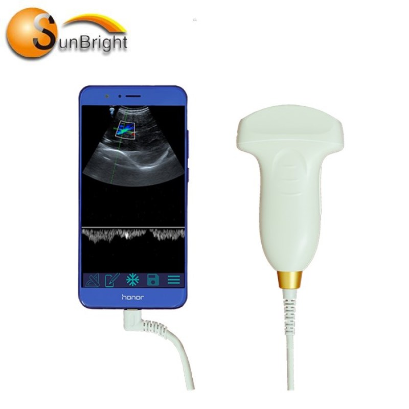 SUN-D1 prueba de embarazo color Doppler PW sonda convexa USB